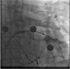Figure 4B.