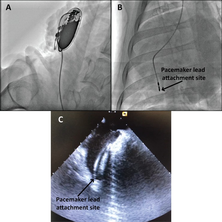 Fig 2