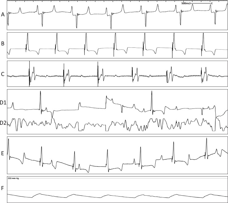 Fig 5