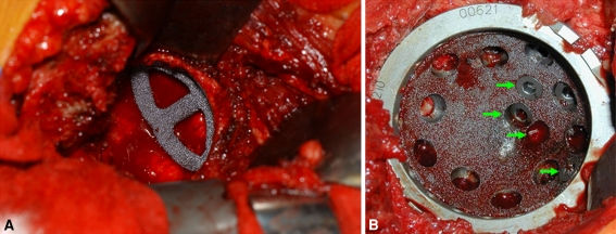 Fig. 1A–B