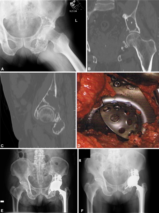 Fig. 2A–F