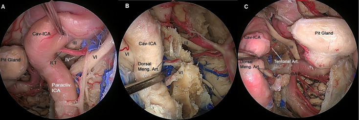 Figure 4