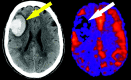 Fig 8.