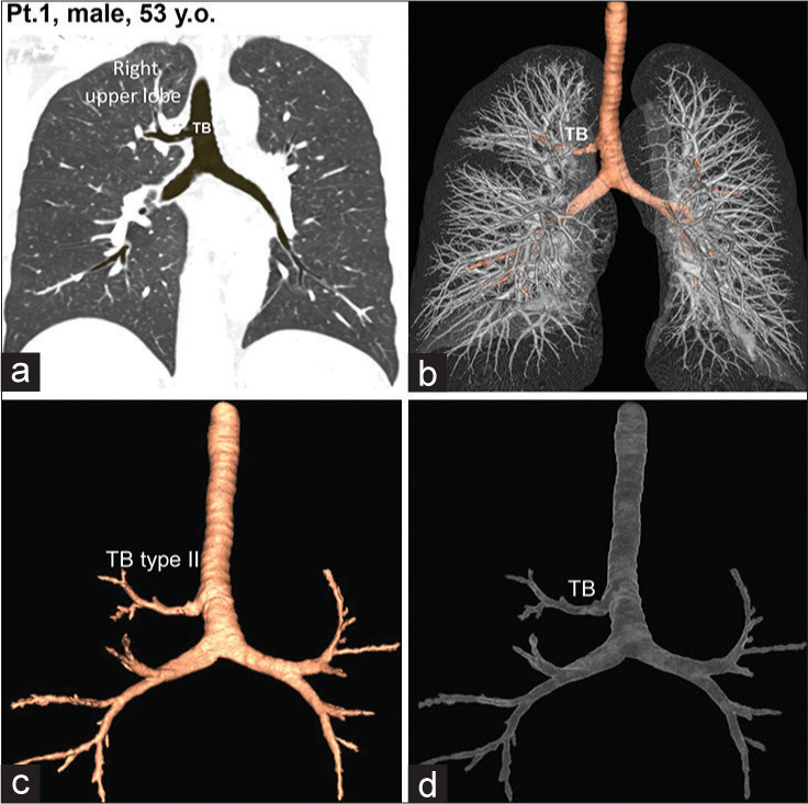 Figure 2: