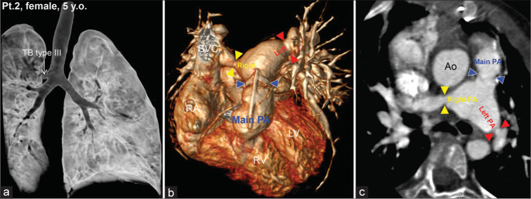 Figure 3: