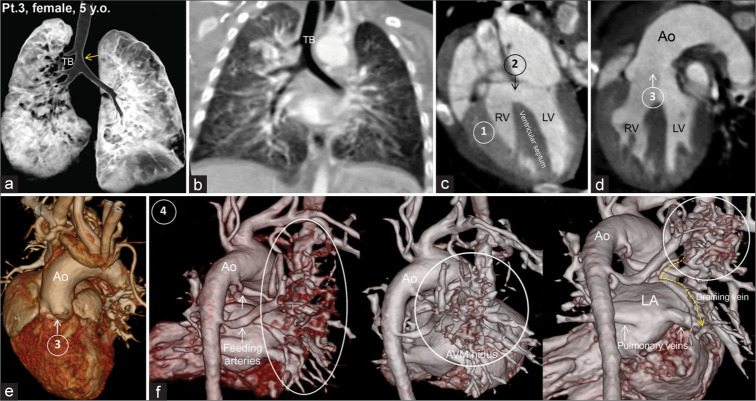 Figure 4: