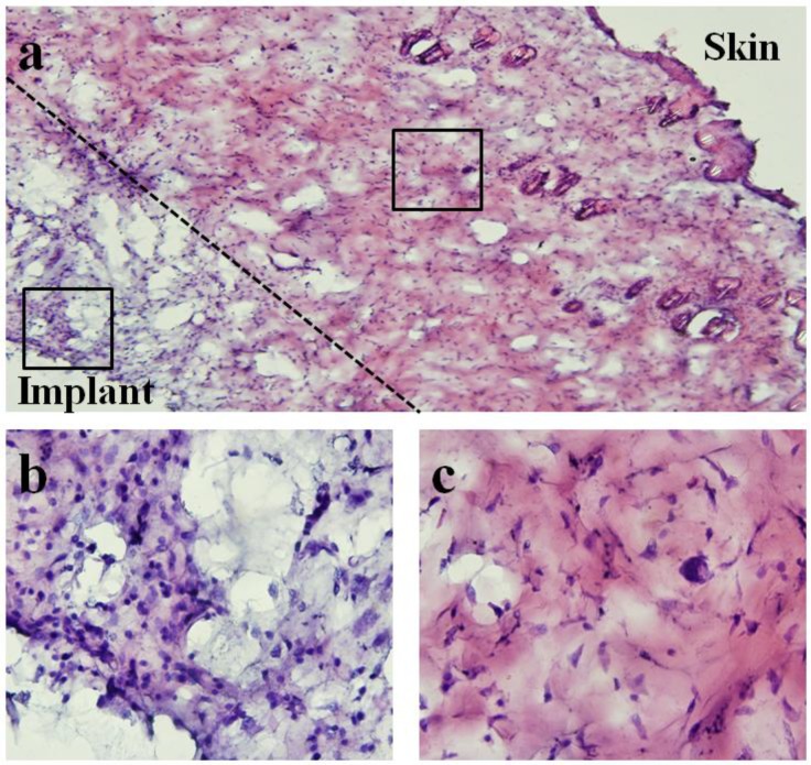 Figure 15