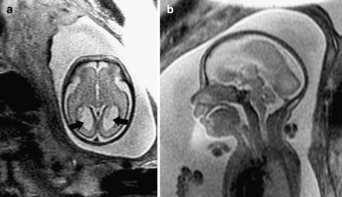 Fig. 5