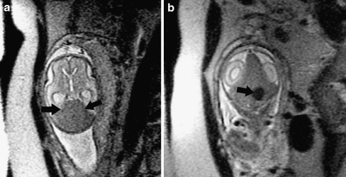 Fig. 14