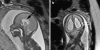 Fig. 13