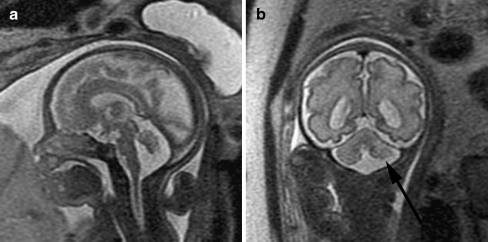 Fig. 12