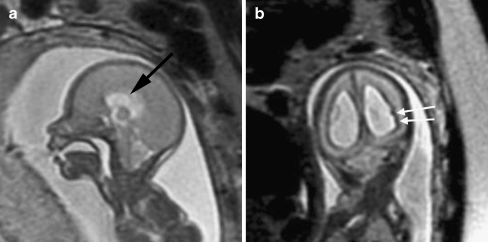 Fig. 13