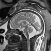 Fig. 11
