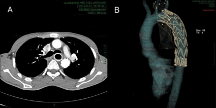 Figure 3A