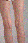 Figure 12.