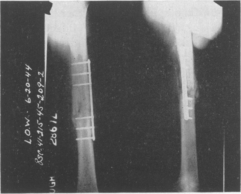 Fig. 1c.