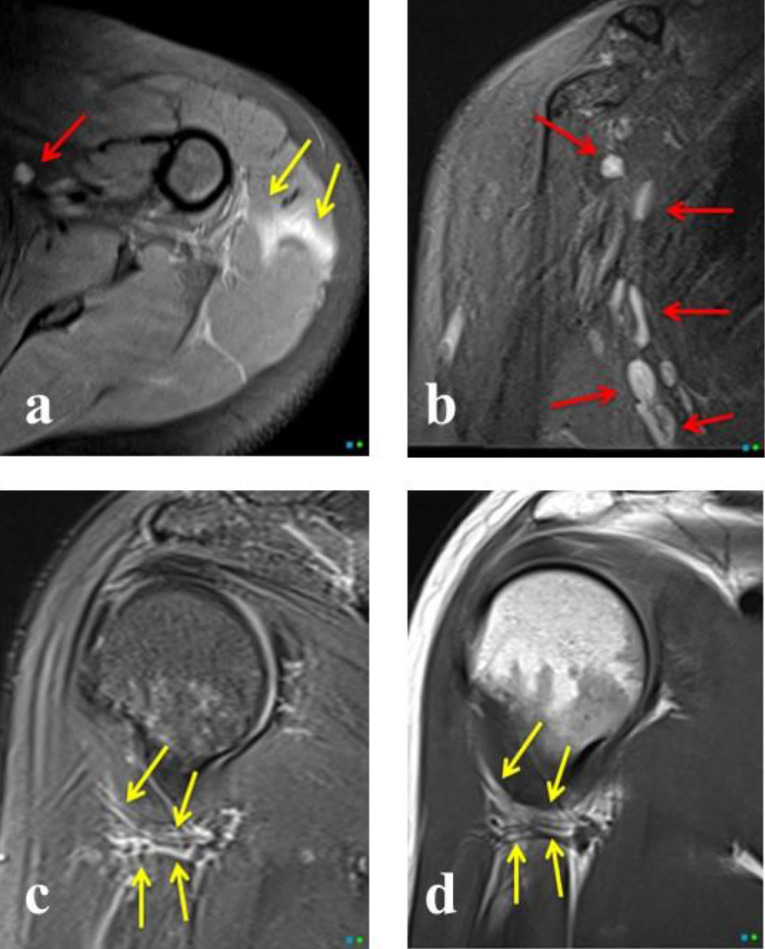 Fig 3 -