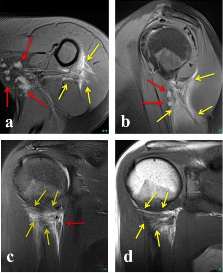 Fig 2 -