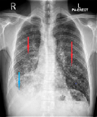 Fig. 1