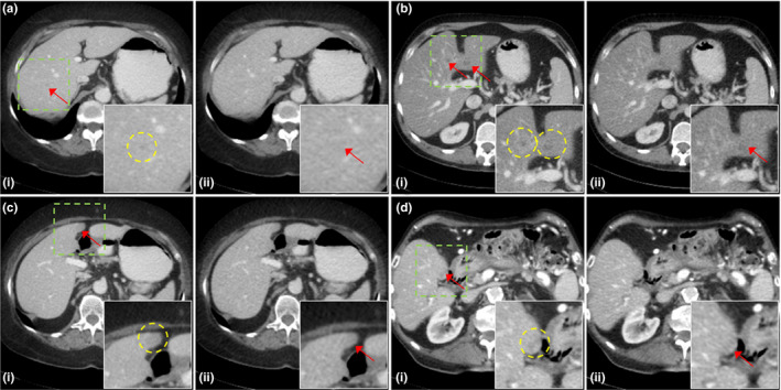 Figure 12