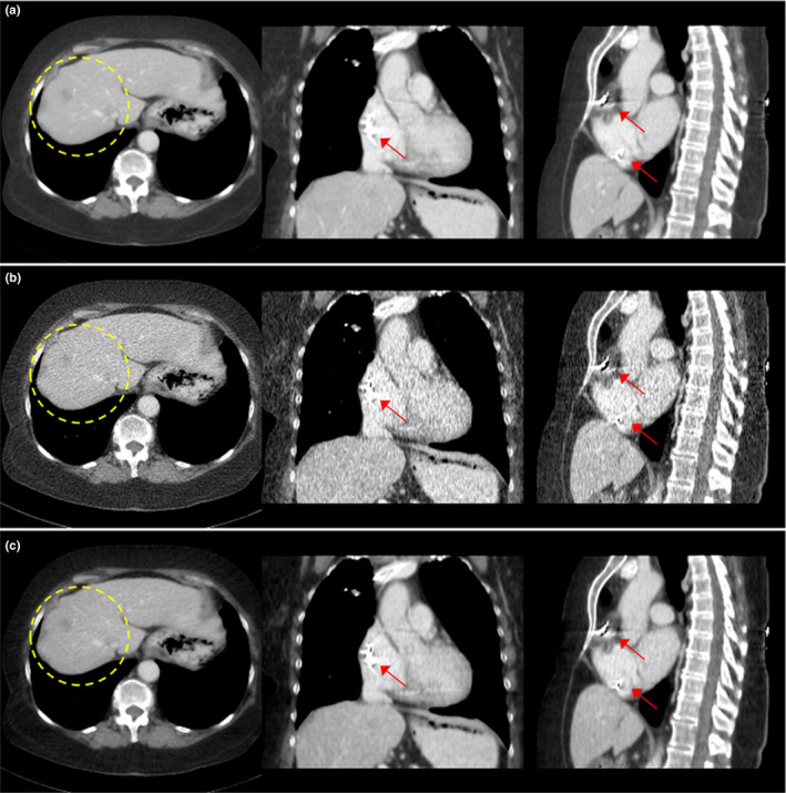 Figure 13