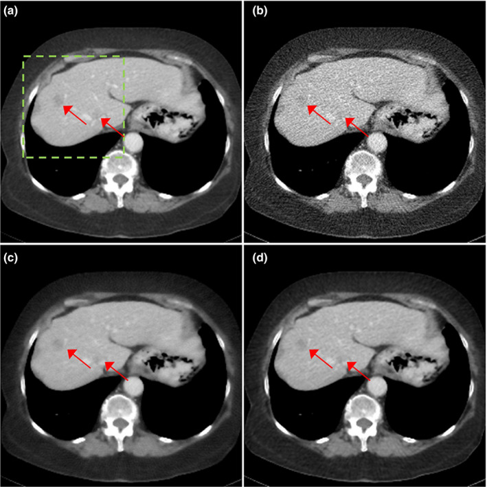 Figure 6