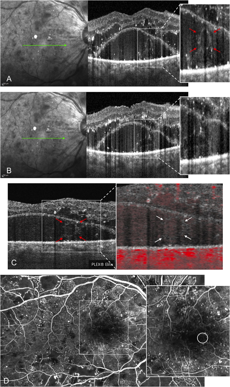 Fig. 1