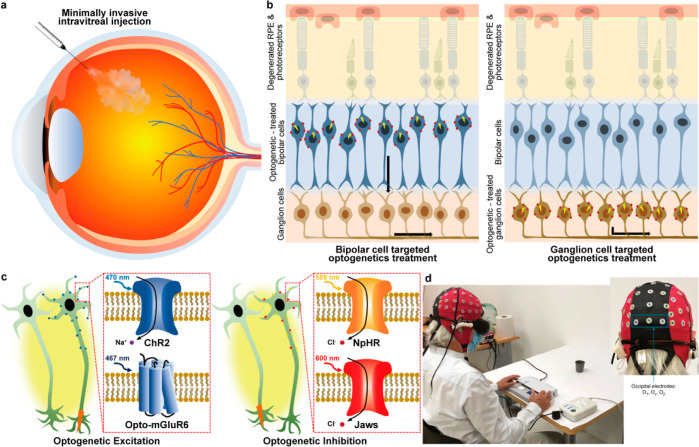 Figure 25