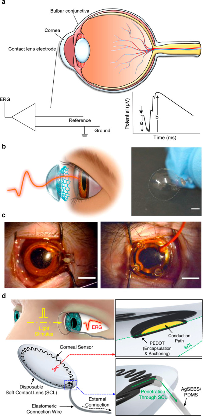 Figure 19