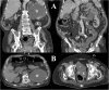 Fig. 1