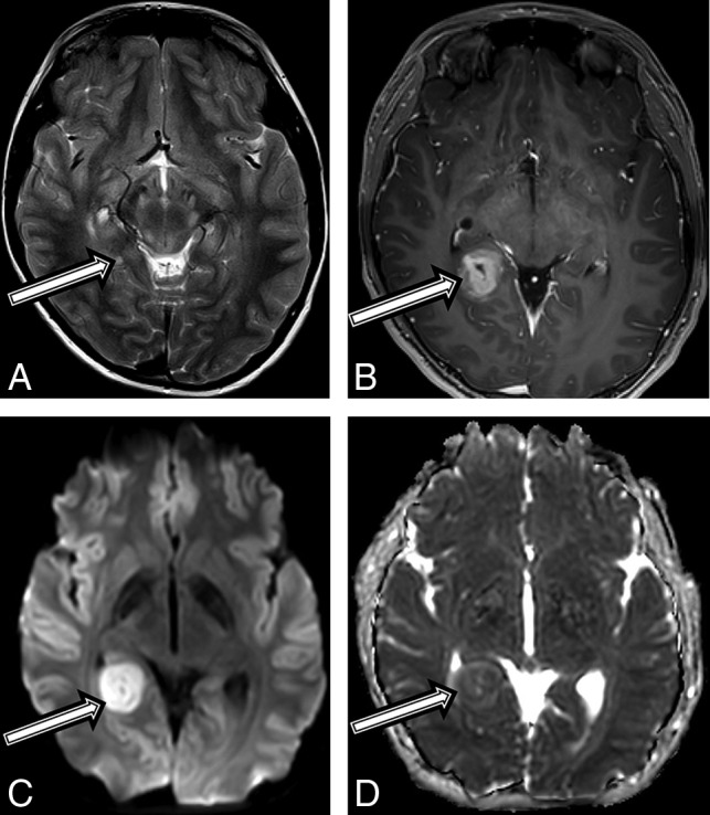 Fig 3.