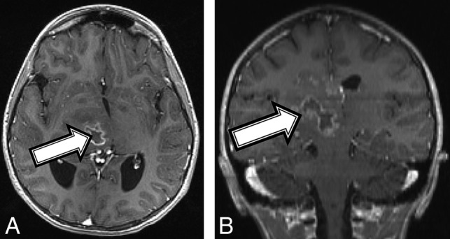 Fig 2.