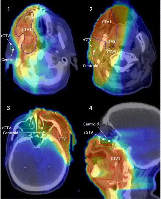 Fig. 4