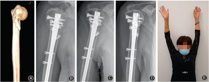 Fig. 8
