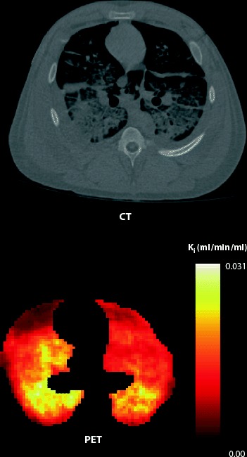 Fig. 1