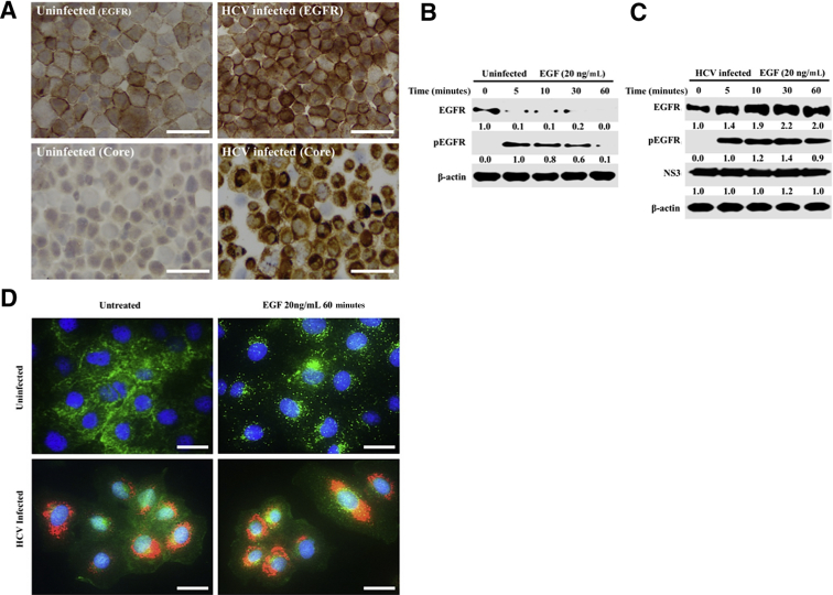 Figure 11