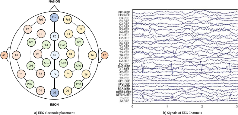 Fig. 1