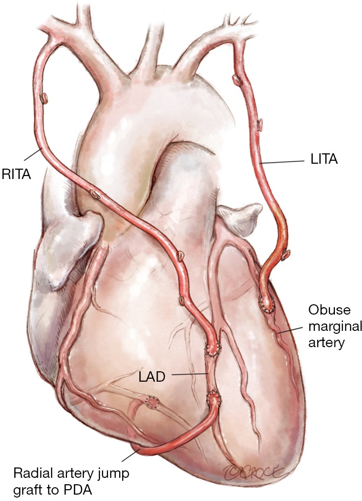 Figure 11