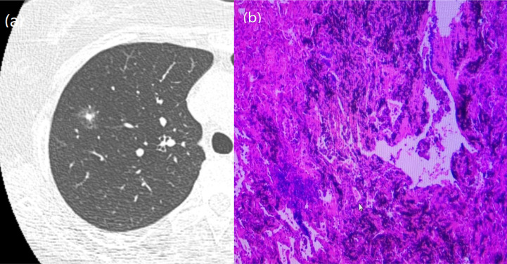 Figure 4