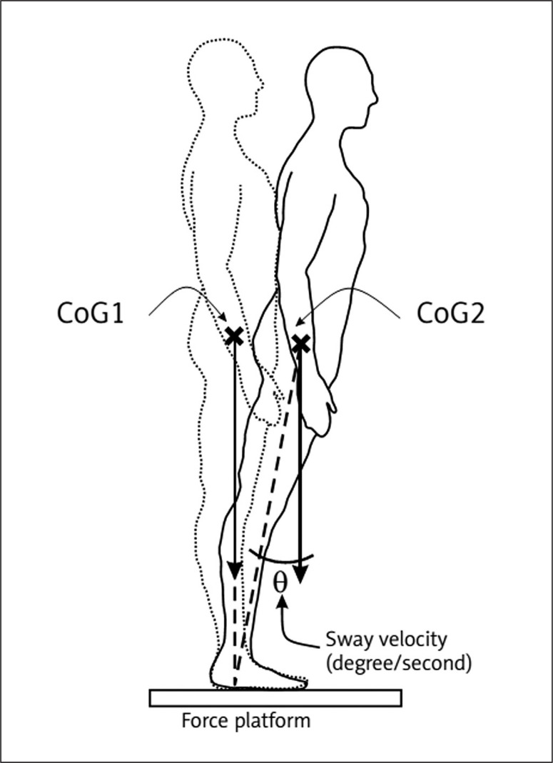 FIG. 1