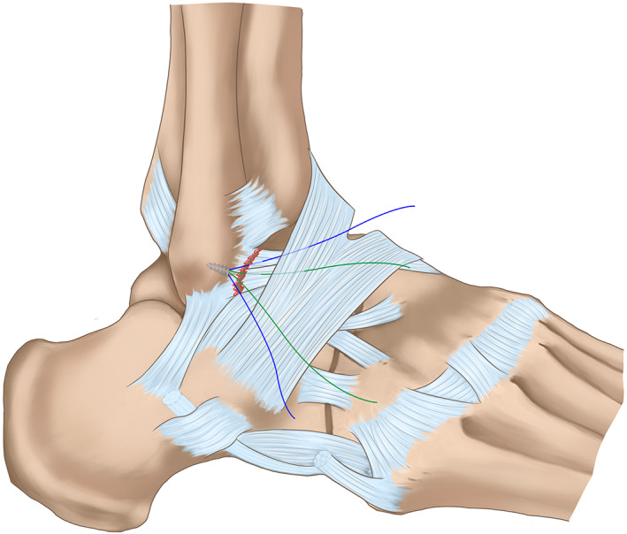 Fig. 3