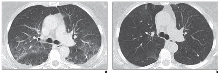 Fig. 11