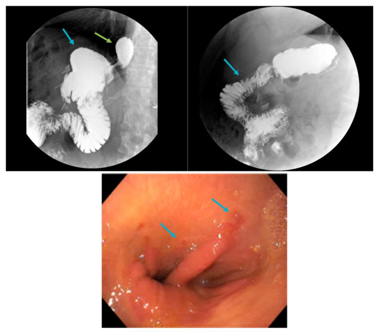 Figure 6