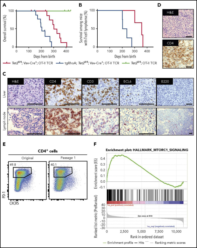 Figure 5. Cd4-RhoA G17V promotes T-cell transformation in concert with Tet2 loss. (A) Overall survival from birth for Tet2fl/fl; Vav-Cre+; OT-II (red, n = 10), tgRhoA; Tet2fl/fl; Vav-Cre+; OT-II (blue, n = 10), or Tet2fl/fl; OT-II (green, n = 4) mice. Mice were immunized monthly with NP40-Ovalbumin, using alum as an adjuvant for up to 7 injections. One mouse from Tet2fl/fl; Vav-Cre+; OT-II and 1 mouse from tgRhoA; Tet2fl/fl; Vav-Cre+; OT-II cohorts were found dead and could not be analyzed. P < .0001 by Mantel-Cox test. (B) Survival of Tet2fl/fl; Vav-Cre+; OT-II (red, n = 3) or tgRhoA; Tet2fl/fl; Vav-Cre+; OT-II (blue, n = 4) mice that were confirmed to have developed T-cell tumors. P = .0177 by Mantel-Cox test. (C) Immunohistochemistry of tgRhoA; Tet2fl/fl; Vav-Cre+; OT-II lymphoma from a mouse that required euthanasia 231 days after birth showing T-cell infiltrate of lymph node and liver with markers as noted. Scale bars, 100 μM. Images taken at ×1000 except for B220 at ×200. (D) Immunohistochemical analysis of the spleen from a mouse transplanted with T-cell tumor 1 from tgRhoA; Tet2fl/fl; Vav-Cre+; OT-II donor. Scale bars, 100 μM. Images taken at ×400. (E) Flow cytometric analysis of CD4+ tumor cells from primary tgRhoA; Tet2fl/fl; Vav-Cre+; OT-II mouse and from secondary recipient. (F) GSEA of Hallmark mTORc1 gene set compared with Tet2fl/fl; Vav-Cre+; OT-II TFH cells (FDR q = 0.001125).