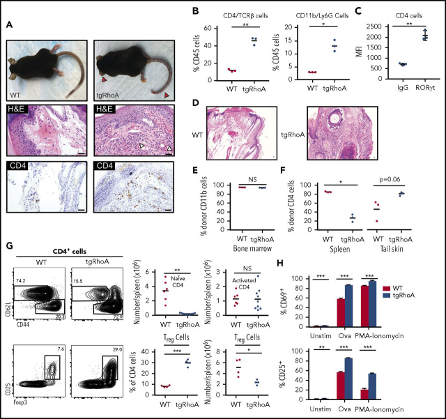 Figure 2. TgRhoA mice develop hematopoietic cell-dependent autoimmunity. (A) Gross findings demonstrating fibrosis of ears and tail (red arrowheads) of mice from the indicated genotypes (top). Hematoxylin and eosin (H&E) staining of mouse tail tips demonstrating a polymorphonuclear cell infiltrate (white arrowheads) and immunohistochemistry of CD4-positive cells (bottom). Scale bars, 100 μm. (B) Percentage of CD4/TCRβ and CD11b/Ly6G cells among CD45+ hematopoietic cells recovered from tail skin. (C) Mean fluorescence intensity of RORγt expression in tgRhoA CD4+ cells compared with isotype control (P = .0076). (D) H&E staining of tail tips from congenic recipient mice 10 weeks after injection with WT or tgRhoA bone marrow. Scale bars, 100 μm. (E) Flow cytometric analysis of bone marrow donor (CD45.1−) CD11b+ cells. (F) Flow cytometric analysis of bone marrow donor (CD45.1−) CD4+ cells in spleen or recovered from tail skin. (G) Representative flow cytometric profiles of splenic CD4+ naive and activated (top) or Treg populations (bottom) along with quantification. Plots and graphs are representative of 3 experiments. (H) Expression of activation markers from sorted CD4+CD62L+CD44−CD25−-naive T cells 48 hours after mixed leukocyte reaction of tgRhoA-OT-II or WT-OT-II T cells unstimulated, stimulated with 5 μg/mL OVA323-339 peptide, or stimulated with PMA/Ionomycin. Data are representative of 2 independent experiments. All P values calculated by t test with Welch's correction.