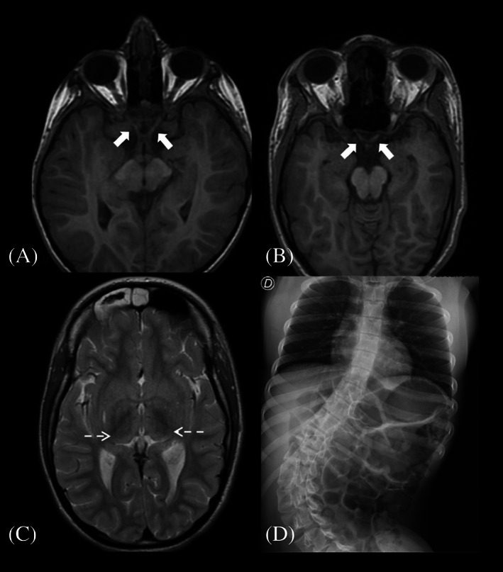 FIGURE 2