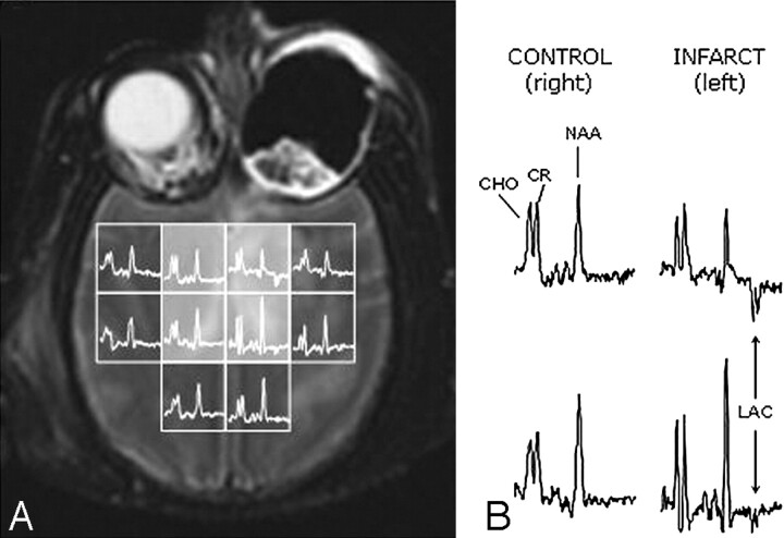 Fig 1.