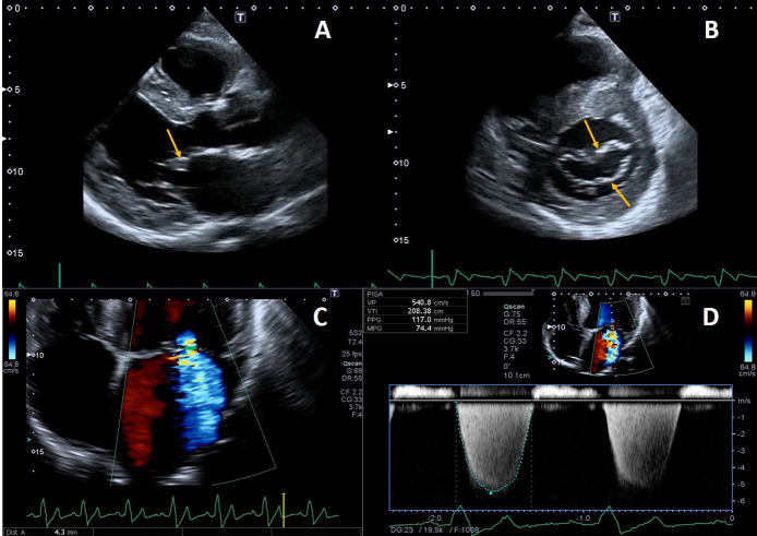 Fig. 4.