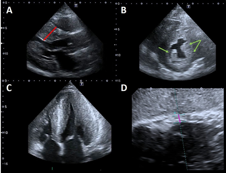 Fig. 2.