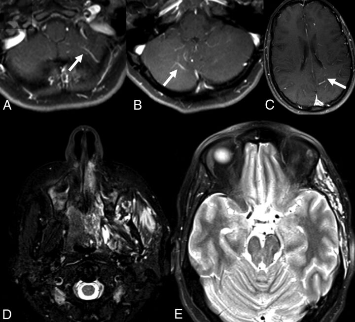 Fig 2.